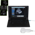 New arrival usb ultrasound probe for laptop in clinics, emergency and outdoor